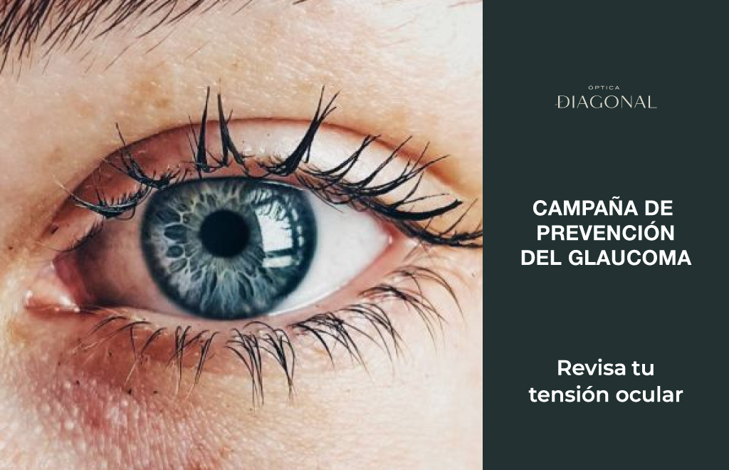 dia mundial del glaucoma, optica diagonal, ourense, vigo