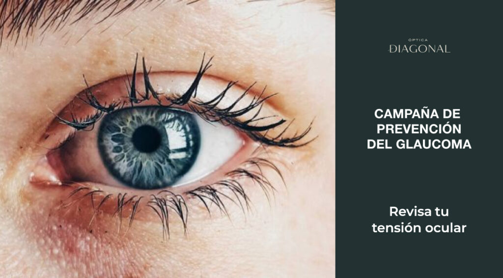 dia mundial del glaucoma, optica diagonal, ourense, vigo